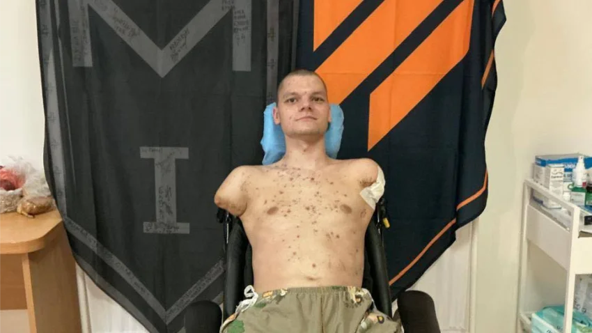  У «ПриватБанку» відмовилися видати картку бійцю без рук: реакція НБУ та позиція банку